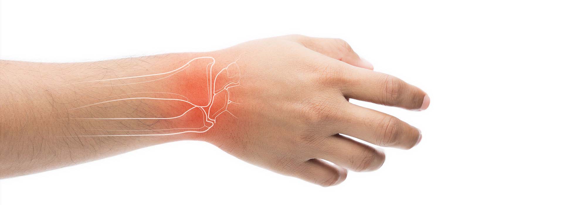 New Approach For Carpal Tunnel Release