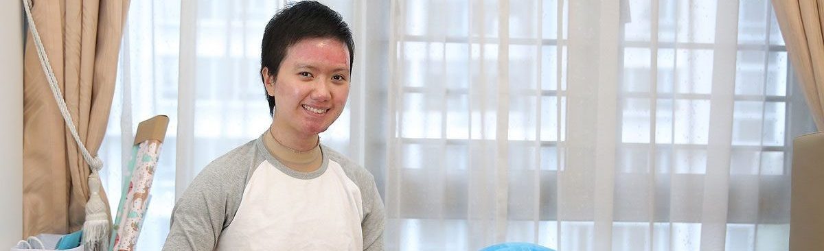Megan Loy: Burn Recovery After The Taiwan Water Park Fire