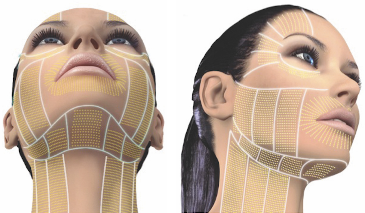 Are You Thinking About A Facelift?