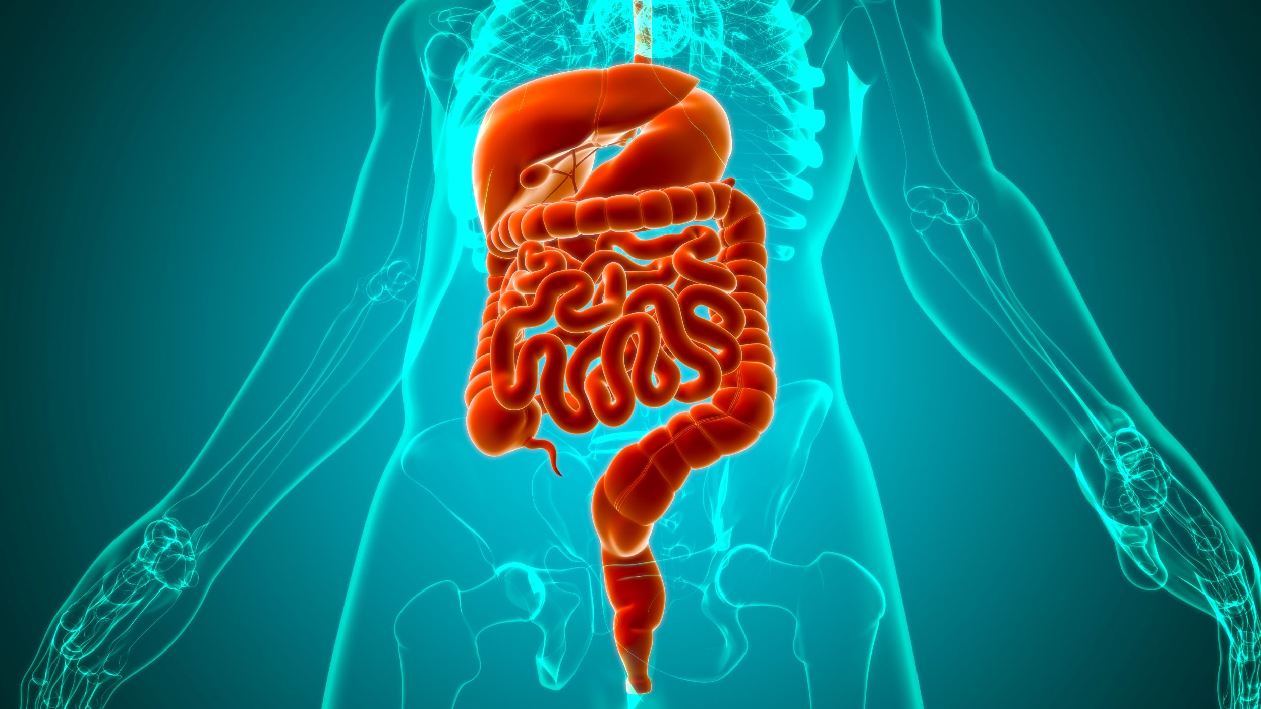 Diverticulosis Vs. Diverticulitis